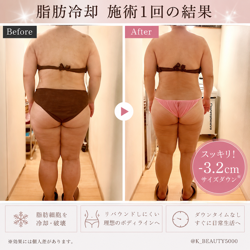 kーbeauty【痩身/フェイシャル専門店】インディバ・ハイパーナイフ・脂肪冷却・アロマ